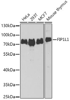 Western blot analysis of extracts of various cell lines, using FIP1L1 antibody  at 1:1000 dilution.
Secondary antibody: HRP Goat Anti-Rabbit IgG   at 1:10000 dilution.
Lysates/proteins: 25ug per lane.
Blocking buffer: 3% nonfat dry milk in TBST.
Detection: ECL Basic Kit .
Exposure time: 90s.