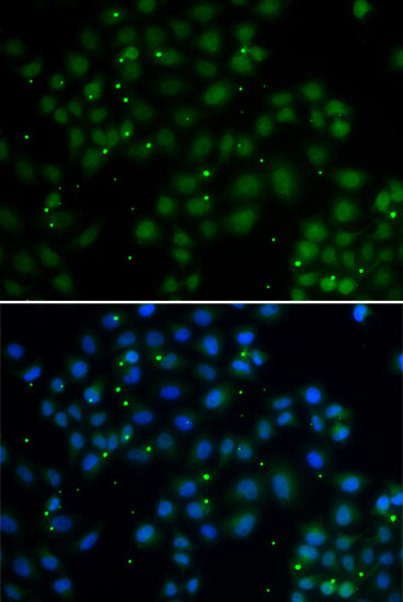 U2AF1L4 polyclonal antibody – Figure 1 of 1