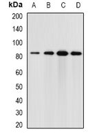 Western blot analysis of extracts of various cell lines, using ELMO3 antibody  at 1:1000 dilution.
Secondary antibody: HRP Goat Anti-Rabbit IgG   at 1:10000 dilution.
Lysates/proteins: 25ug per lane.
Blocking buffer: 3% nonfat dry milk in TBST.
Detection: ECL Enhanced Kit .
Exposure time: 30s.