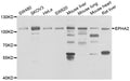 Western blot analysis of extracts of various cell lines, using EPHA2  antibody  at 1:1000 dilution.
Secondary antibody: HRP Goat Anti-Rabbit IgG   at 1:10000 dilution.
Lysates/proteins: 25ug per lane.
Blocking buffer: 3% nonfat dry milk in TBST.
Detection: ECL Enhanced Kit .
Exposure time: 180s.