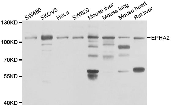 Western blot analysis of extracts of various cell lines, using EPHA2  antibody  at 1:1000 dilution.
Secondary antibody: HRP Goat Anti-Rabbit IgG   at 1:10000 dilution.
Lysates/proteins: 25ug per lane.
Blocking buffer: 3% nonfat dry milk in TBST.
Detection: ECL Enhanced Kit .
Exposure time: 180s.