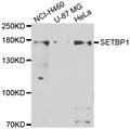 Western blot analysis of extracts of various cell lines, using SETBP1 antibody.