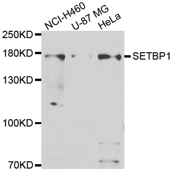 Western blot analysis of extracts of various cell lines, using SETBP1 antibody.