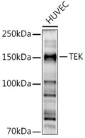 Western blot analysis of extracts of HUVEC cells, using TEK  antibody  at 1:500 dilution.
Secondary antibody: HRP Goat…