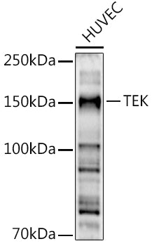 Western blot analysis of extracts of HUVEC cells, using TEK  antibody  at 1:500 dilution.
Secondary antibody: HRP Goat…
