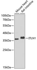Western blot analysis of extracts of various cell lines, using ITLN1 antibody  at 1:1000 dilution.
Secondary antibody: HRP Goat Anti-Rabbit IgG   at 1:10000 dilution.
Lysates/proteins: 25ug per lane.
Blocking buffer: 3% nonfat dry milk in TBST.
Detection: ECL Basic Kit .
Exposure time: 90s.