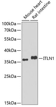 Western blot analysis of extracts of various cell lines, using ITLN1 antibody  at 1:1000 dilution.
Secondary antibody: HRP Goat Anti-Rabbit IgG   at 1:10000 dilution.
Lysates/proteins: 25ug per lane.
Blocking buffer: 3% nonfat dry milk in TBST.
Detection: ECL Basic Kit .
Exposure time: 90s.