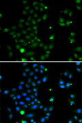 Immunofluorescence analysis of MCF-7 cells using GCM1 antibody . Blue: DAPI for nuclear staining.