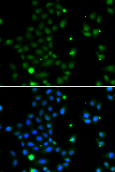 Immunofluorescence analysis of MCF-7 cells using GCM1 antibody . Blue: DAPI for nuclear staining.