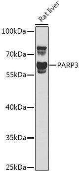 Western blot analysis of extracts of Rat liver, using PARP3 antibody  at 1:1000 dilution.
Secondary antibody: HRP Goat Anti-Rabbit IgG   at 1:10000 dilution.
Lysates/proteins: 25ug per lane.
Blocking buffer: 3% nonfat dry milk in TBST.
Detection: ECL Basic Kit .
Exposure time: 90s.