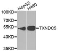Western blot analysis of extracts of various cell lines, using TXNDC5 antibody.