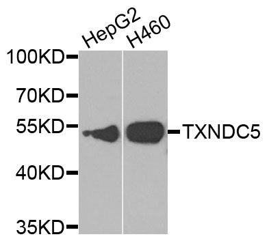 Western blot analysis of extracts of various cell lines, using TXNDC5 antibody.