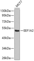Western blot analysis of extracts of MCF-7 cells, using EEF1A2 antibody .
Secondary antibody: HRP Goat Anti-Rabbit IgG   at 1:10000 dilution.
Lysates/proteins: 25ug per lane.
Blocking buffer: 3% nonfat dry milk in TBST.