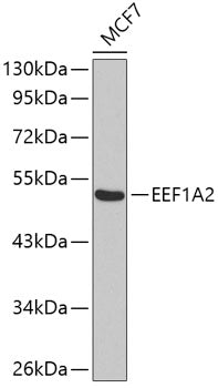 Western blot analysis of extracts of MCF-7 cells, using EEF1A2 antibody .
Secondary antibody: HRP Goat Anti-Rabbit IgG   at 1:10000 dilution.
Lysates/proteins: 25ug per lane.
Blocking buffer: 3% nonfat dry milk in TBST.