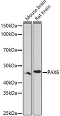 Western blot analysis of extracts of various cell lines, using PAX6 antibody  at 1:1000 dilution.
Secondary antibody: HRP Goat Anti-Rabbit IgG   at 1:10000 dilution.
Lysates/proteins: 25ug per lane.
Blocking buffer: 3% nonfat dry milk in TBST.
Detection: ECL Enhanced Kit .
Exposure time: 180s.