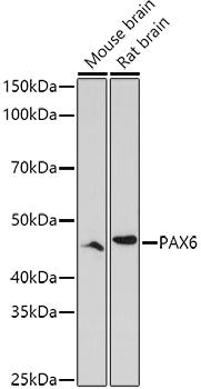 Western blot analysis of extracts of various cell lines, using PAX6 antibody  at 1:1000 dilution.
Secondary antibody: HRP Goat Anti-Rabbit IgG   at 1:10000 dilution.
Lysates/proteins: 25ug per lane.
Blocking buffer: 3% nonfat dry milk in TBST.
Detection: ECL Enhanced Kit .
Exposure time: 180s.