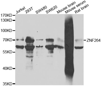 Western blot analysis of extracts of various cell lines, using ZNF264 antibody.