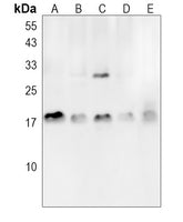 Western blot analysis of extracts of various cell lines, using FGFBP1 antibody  at 1:1000 dilution.
Secondary antibody: HRP Goat Anti-Rabbit IgG   at 1:10000 dilution.
Lysates/proteins: 25ug per lane.
Blocking buffer: 3% nonfat dry milk in TBST.
Detection: ECL Basic Kit .
Exposure time: 30s.