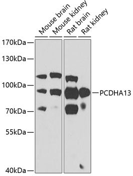 Western blot analysis of extracts of various cell lines, using PCDHA13 antibody  at 1:1000 dilution.
Secondary antibody: HRP Goat Anti-Rabbit IgG   at 1:10000 dilution.
Lysates/proteins: 25ug per lane.
Blocking buffer: 3% nonfat dry milk in TBST.
Detection: ECL Basic Kit .
Exposure time: 90s.