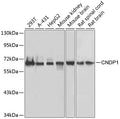 Western blot analysis of extracts of various cell lines, using CNDP1 antibody  at 1:1000 dilution.
Secondary antibody: HRP Goat Anti-Rabbit IgG   at 1:10000 dilution.
Lysates/proteins: 25ug per lane.
Blocking buffer: 3% nonfat dry milk in TBST.
Detection: ECL Basic Kit .
Exposure time: 5s.