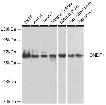 Western blot analysis of extracts of various cell lines, using CNDP1 antibody  at 1:1000 dilution.
Secondary antibody: HRP Goat Anti-Rabbit IgG   at 1:10000 dilution.
Lysates/proteins: 25ug per lane.
Blocking buffer: 3% nonfat dry milk in TBST.
Detection: ECL Basic Kit .
Exposure time: 5s.