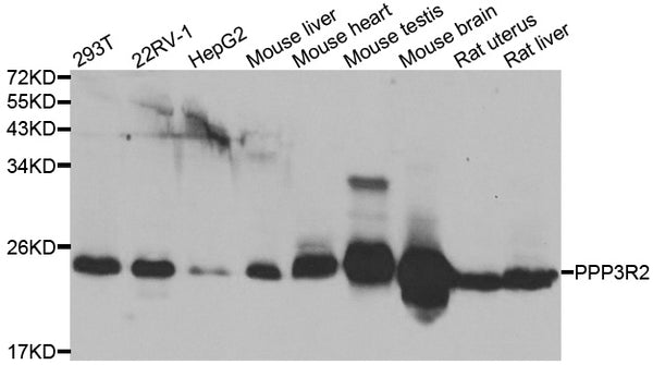 Western blot analysis of extracts of various cell lines, using PPP3R2 antibody.