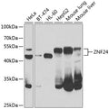 Western blot analysis of extracts of various cell lines, using ZNF24 antibody  at 1:1000 dilution.
Secondary antibody: HRP Goat Anti-Rabbit IgG   at 1:10000 dilution.
Lysates/proteins: 25ug per lane.
Blocking buffer: 3% nonfat dry milk in TBST.
Detection: ECL Enhanced Kit .
Exposure time: 90s.