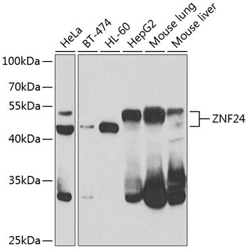 Western blot analysis of extracts of various cell lines, using ZNF24 antibody  at 1:1000 dilution.
Secondary antibody: HRP Goat Anti-Rabbit IgG   at 1:10000 dilution.
Lysates/proteins: 25ug per lane.
Blocking buffer: 3% nonfat dry milk in TBST.
Detection: ECL Enhanced Kit .
Exposure time: 90s.