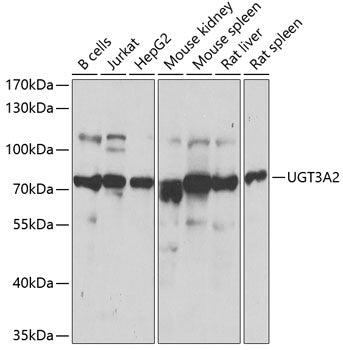 Western blot analysis of extracts of various cell lines, using UGT3A2 antibody.
