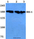 IRS-1 (D606) polyclonal antibody – Figure 1 of 2