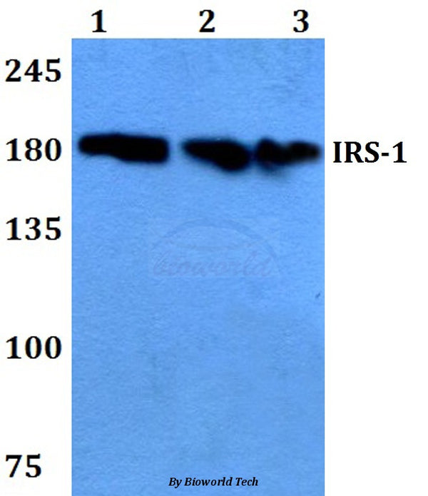 IRS-1 (D606) polyclonal antibody – Figure 1 of 2