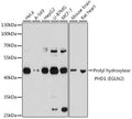 Western blot analysis of extracts of various cell lines, using Prolyl hydroxylase PHD1 ) antibody  at 1:1000 dilution.
Secondary antibody: HRP Goat Anti-Rabbit IgG   at 1:10000 dilution.
Lysates/proteins: 25ug per lane.
Blocking buffer: 3% nonfat dry milk in TBST.
Detection: ECL Basic Kit .
Exposure time: 30s.