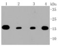 TOM20 Rabbit monoclonal antibody - Figure 1 of 1