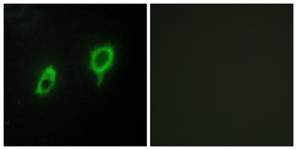 14-3-3 Gamma Polyclonal Antibody – Figure 1 of 1
