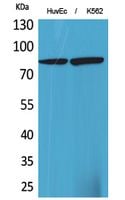 Western Blot analysis of HuvEc, K562 cells using 17β-HSD4 Polyclonal Antibody. Secondary antibody was diluted at 1:20000