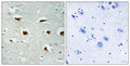 Immunohistochemistry analysis of paraffin-embedded human brain tissue, using 4E-BP1 Antibody. The picture on the right is blocked with the synthesized peptide.