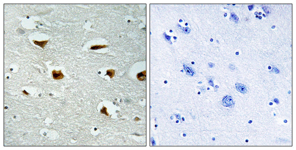 Immunohistochemistry analysis of paraffin-embedded human brain tissue, using 4E-BP1 Antibody. The picture on the right is blocked with the synthesized peptide.
