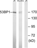 53BP1 Polyclonal Antibody – Figure 1 of 1