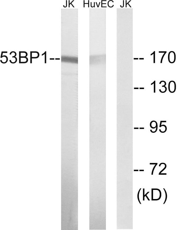 53BP1 Polyclonal Antibody – Figure 1 of 1