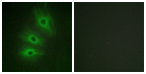 A Cyclase V/VI Polyclonal Antibody – Figure 1 of 1