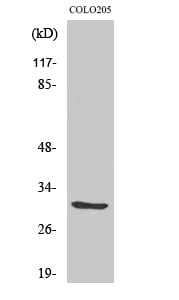 ABHD11 Polyclonal Antibody – Figure 1 of 1