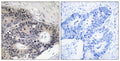 ABHD12B Polyclonal Antibody – Figure 1 of 1