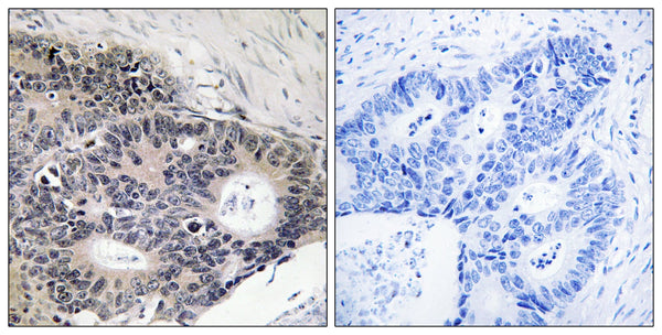 ABHD12B Polyclonal Antibody – Figure 1 of 1