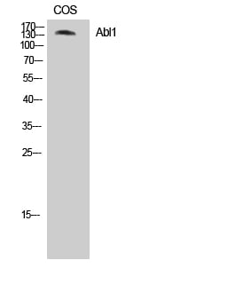 Abl1 Polyclonal Antibody – Figure 1 of 1