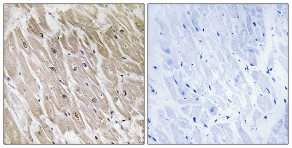 ACAD-10 Polyclonal Antibody – Figure 1 of 1