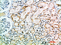 ACE1 Polyclonal Antibody – Figure 1 of 1