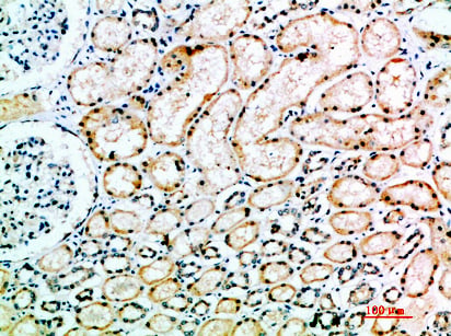 ACE1 Polyclonal Antibody – Figure 1 of 1