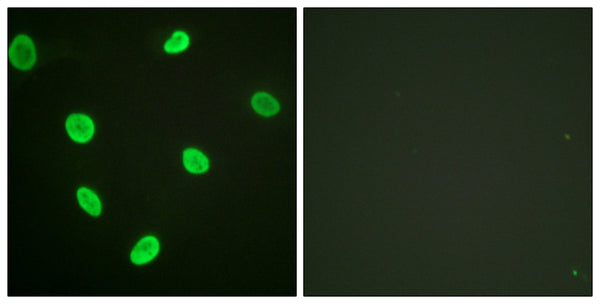 Acetyl Histone H2B (K12) Polyclonal Antibody – Figure 1 of 1