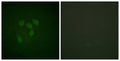 Acetyl p53 (K319) Polyclonal Antibody – Figure 1 of 1