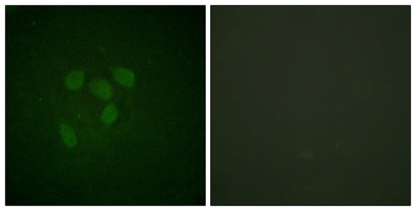 Acetyl p53 (K319) Polyclonal Antibody – Figure 1 of 1